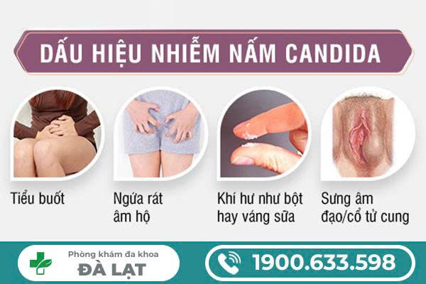 Hình ảnh minh họa